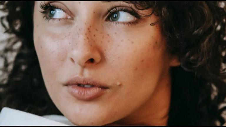 how to remove black spots on face 